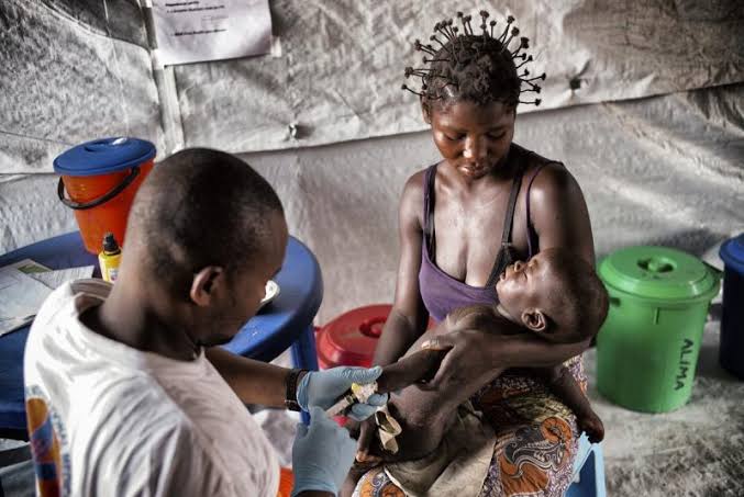 Kasaï oriental : 4 nouveaux cas de rougeole détectés dans la zone de santé de Kabeya Kamwanga