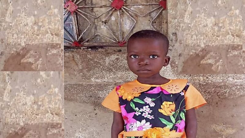 Kasaï oriental : la jeune Ngalula Makolo née sans anus a besoin d’une intervention chirurgicale